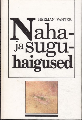 Naha- ja suguhaigused